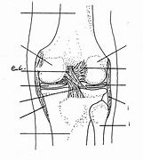 Image result for Knee Labeling