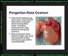 Image result for Penyakit Kista Ketika Dipencet