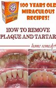 Image result for How to Avoid Plaque On Teeth