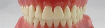 Image result for Ideal Bite Teeth