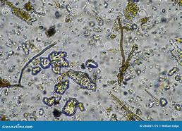 Image result for Fungal Hyphae in Soil