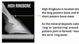 Image result for Ring Finger Bone Anatomy