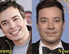 Image result for Jimmy Fallon Plastic Surgery