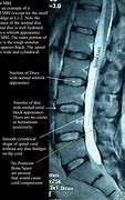 Image result for Lumbar and Sacral Spine