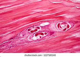 Image result for Trichinosis Parasite