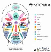 Image result for Acne Boy Face Map