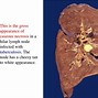 Image result for Necrosis Histology