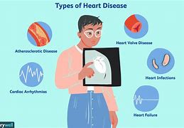 Image result for Heart Disease Photos