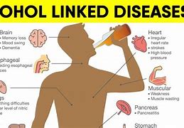 Image result for Diseases From Drinking Alcohol