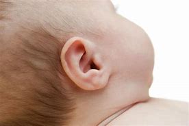 Image result for Ear of Boy