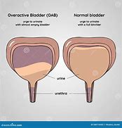 Image result for Normal Bladder