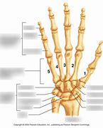 Image result for Carpal Angle