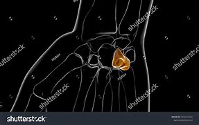 Image result for hamate bone x-ray