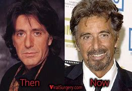 Image result for Al Pacino Facelift