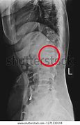 Image result for Transverse Spine