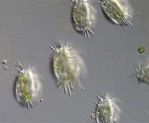 Image result for Protozoan