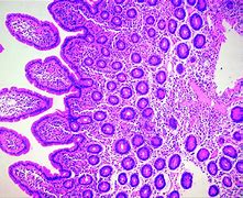 Image result for Duodenal Mucosa