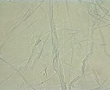 Image result for Fungal Hyphae and Spores