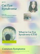 Image result for Cat Eye Syndrome