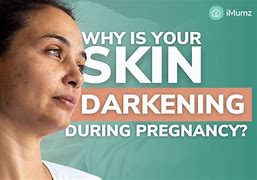 Image result for Skin Darkening