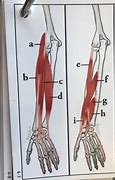 Image result for Wrist Muscles