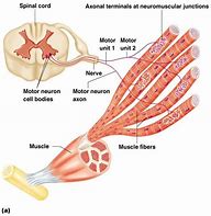 Image result for Micro Tears in Muscle Fiber Under Microscopes