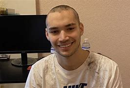 Image result for Adin Ross Balding