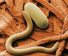 Image result for Nematodes