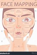 Image result for Acne Boy Face Map