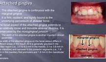 Image result for Col Gingiva