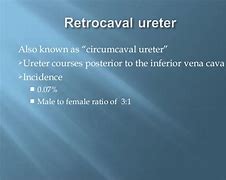 Image result for Retrocaval Ureter X-ray