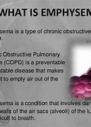 Image result for Emphysema