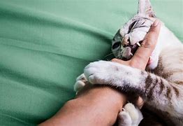 Image result for Cat Bite On Finger