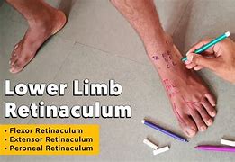 Image result for Retinaculum Leg