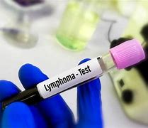 Image result for Lymphoma Panel