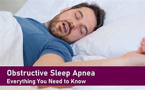 Image result for Osa Sleep Apnea