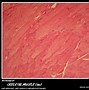 Image result for Micro Tears in Muscle Fiber Under Microscopes