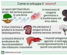 Image result for Tetano Muscolare