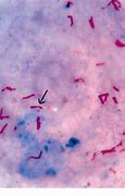 Image result for Mycobacterium GM's Stain