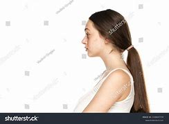 Image result for Acne On Side of Face