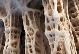 Image result for Bone Cell Picture B