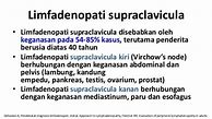 Image result for Patofisiologi Limfadenopati