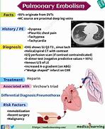 Image result for Pulmonary Embolism Post-Mortem Changes