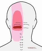 Image result for Headache Left Side of Head