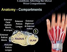 Image result for Dorsal Aspect Wrist