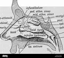 Image result for Infundibulum Nose