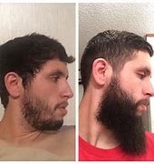 Image result for Gross Beard