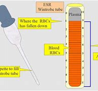 Image result for ESR Procedure