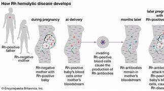 Image result for RH Blood Group System