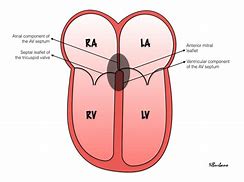 Image result for Atrioventricular Septum